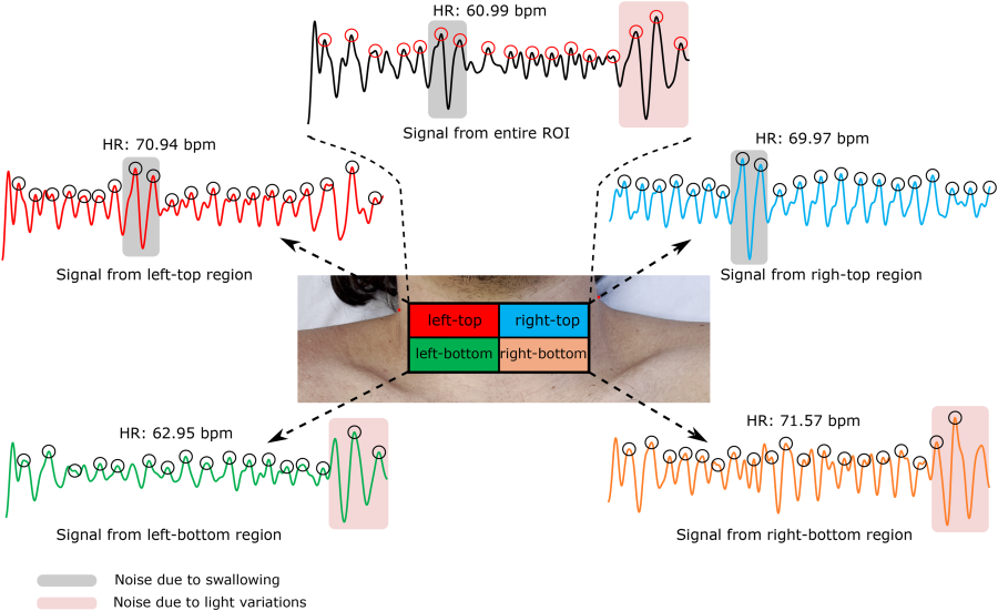 Heart Rate Monitoring From Smartphone Neck Videos Using Remote Photoplethysmography